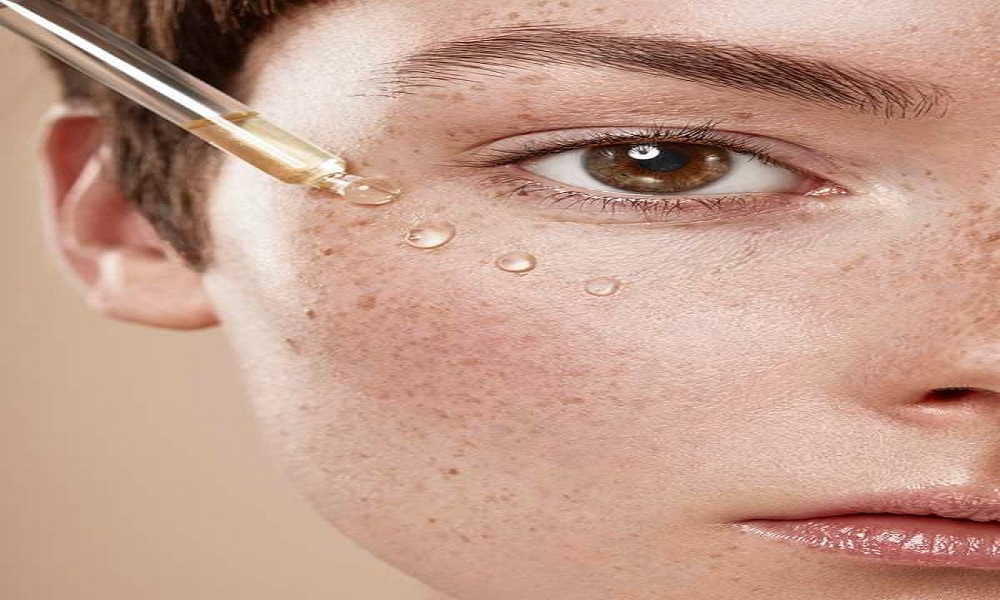 طرق سحرية لعلاج مشكلة الرؤوس السوداء