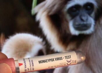 جدري القردة